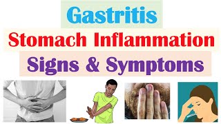 Gastritis Stomach Inflammation Signs amp Symptoms Complications amp Why They Occur [upl. by Nihs]