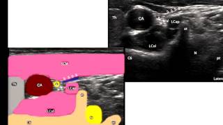 Pain Medicine  Cervical Sympathetic Trunk [upl. by Karr]