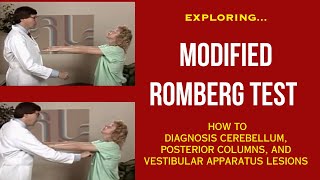 Exploring Romberg Test Diagnosis Cerebellum Posterior Columns and Vestibular Apparatus lesions [upl. by My981]