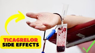 Ticagrelor side effects uses and benefits [upl. by Kcirded]