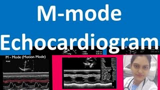 M Mode Measurements Echocardiography in Hindi By Babita [upl. by Aikit]