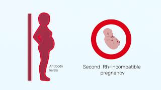 How Rh factor affects a pregnancy [upl. by Lory669]