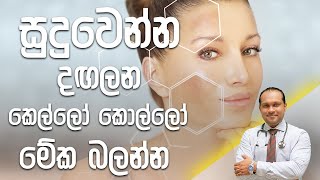 සුදුවෙන්න දඟලන කෙල්ලෝ කොල්ලෝ මේක බලන්න  Dr Namal Wijesinghe [upl. by Hillegass]