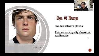 Mumps Disease [upl. by Hannon838]