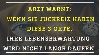 Warnung des Arztes Wenn Sie an diesen 3 Stellen Juckreiz haben [upl. by Ahc]