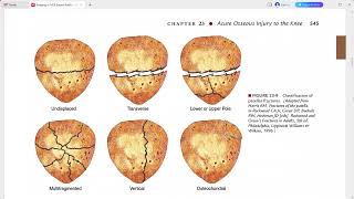 RADIOLOGY EXAM CASES [upl. by Aizatsana]