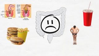 Diarrhoeal diseases [upl. by Orimlede]