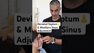 Deviated Septum amp Maxillary Sinus Adjustment chiropractic shorts [upl. by Black]