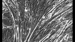 C2C12 muscle cell contractions Part II [upl. by Aaronson]