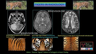 RECAP SERIES TIGERS IN RADIOLOGY [upl. by Agler]