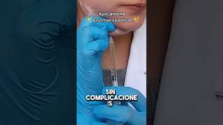 Acompáñame aplicandome enzimas lipoliticas para eliminar la papada tratamientofacial [upl. by Donegan650]