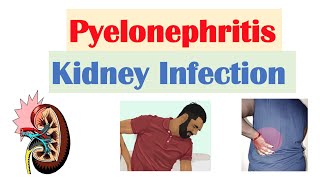 Pyelonephritis Kidney Infection  Causes Pathophysiology Signs amp Symptoms Diagnosis Treatment [upl. by Wyly]