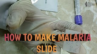 How to make malaria slides2 ways to make malaria slides [upl. by Innoc]