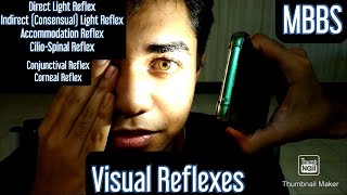 Visual Reflexes Direct Light Reflex Indirect Consensual Light Reflex Accommodation Reflex mbbs [upl. by Ellehcram]