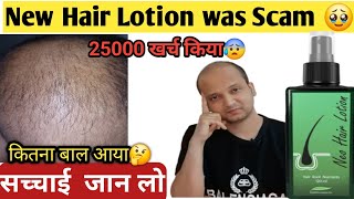 Neo Hair Lotion Result was Scam 🤔Really [upl. by Danczyk]