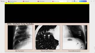 RADIOLOGY EXAM CASES [upl. by Maryly]