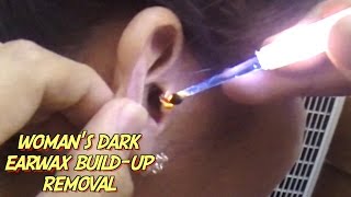 Womans Dark Earwax Buildup Removal [upl. by Naened]