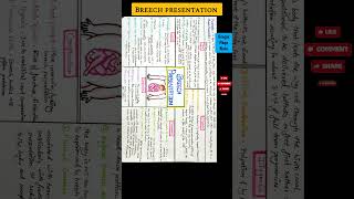 Breech presentation [upl. by Coates]