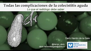 593 Todas las complicaciones de la colecistitis aguda Curso de Avances en Radiologia Abdominal [upl. by Aenea]