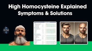 High Homocysteine Explained Hair loss Symptoms and Solutions [upl. by Pammi]