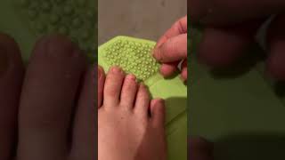 Pedicure Onychomycosis Stress Relief satisfying nails impactedtoenail [upl. by Lizbeth]