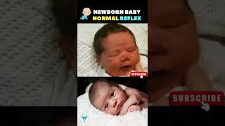 Newborn Baby Normal Reflex❤️🥰 Baby reflex  Baby movement  Infant reflexes shortsvideo pregnancy [upl. by Prendergast609]