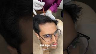 PRP Treatment For Hair loss  Best Hair Regrowth Treatment For Men prptreatment [upl. by Yasmine118]