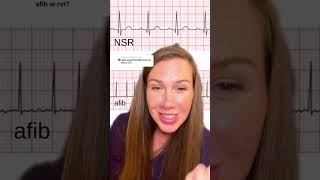 What Afib with RVR looks like on a rhythm strip [upl. by Leirza538]