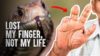 How to Survive The Most Dangerous Snake Bites  Part 2 [upl. by Xenos]