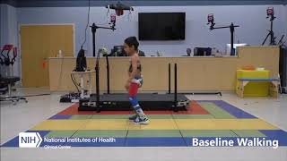 Robotic exoskeleton alleviates crouch gait in children with cerebral palsy [upl. by Najtsirk]