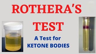 Rotheras Test For Ketone in hindi [upl. by Biles544]