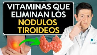 Como eliminar Nódulos en la Tiroides Dr Antonio Cota Sugar Care [upl. by Beekman149]