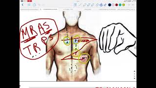 Mastering The Art of Precordial Examination  Auscultation 🩺 [upl. by Sharman]