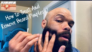 Ingrown Hair vs Beard Pimples  How To Treat and Remove Beard Pimples [upl. by Haldas]