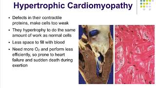 Pathophysiology Ch18 Alterations in Cardiac Function [upl. by Ynottirb]