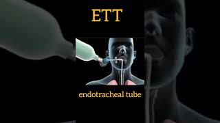 endotracheal tube  ETT musicemergency ett viralvideo trending [upl. by Lennahc662]