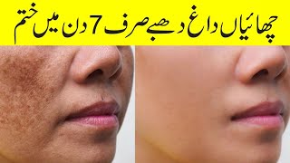 Mulethi Face Mask  Skin Whitening  Hyperpigmentation  Acne  Pimple  Dark Spots [upl. by Eibloc237]