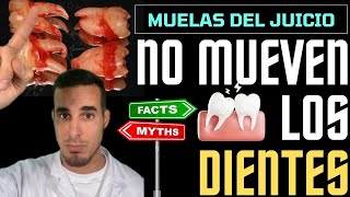 Las MUELAS del JUICIO NO DESPLAZAN LOS DIENTES  Mito desmentido✅ [upl. by Awad]