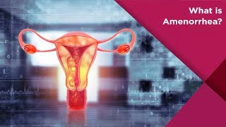 Amenorrhea Absence of Menses  Causes  symptoms amp treatment  Medical Mind [upl. by Buxton]