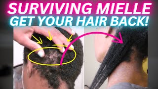 GET YOUR HAIR BACK  RECOVER FROM MIELLE DAMAGE SCIENTIFICALLY PROVEN [upl. by Goldin]