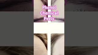 phenol Chemical peels chemicalpeels skincare glassskin viralvideo viralshorts [upl. by Ennaimaj]