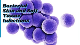 bacterial skin and soft tissue infections [upl. by Anivla192]