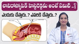 What is Laparoscopic Hysterectomy  Hysterectomy Explained by  DrSumina Reddy  Fertilica IVF [upl. by Eenyaj]