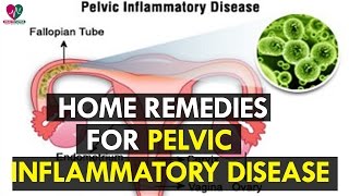 Home Remedies for Pelvic Inflammatory Disease  Healh Sutra [upl. by Marchal]