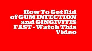 Natural Gum Infection Cure For Bleeding Gums Gum Disease and Gingivitis [upl. by Herzig399]