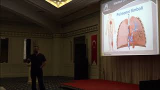 Akciğer Pıhtısı Pulmoner Emboli nedir nasıl oluşur  Prof Dr Ahmet AKGUL [upl. by Jessica]