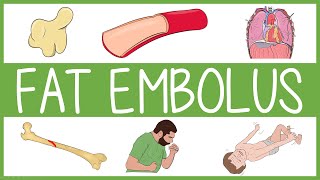 Fat Embolism Syndrome [upl. by Elime539]