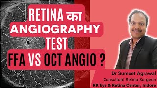 आँख की Angiography test कौनसी है बेहतर  OCT Angiography या Fluorescein Angiography [upl. by Karlee]