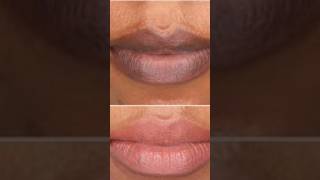 Home Remedy For Darklips darklips drylips homemade remedy viralshort diy beautyguider2395 [upl. by Ahsaeyt]