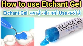 How to use Etchant GelWhat is Etchant gelDental Bharat [upl. by Hairej]